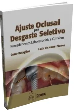 Livro Ajuste Oclusal por Desgaste Seletivo. Procedimentos Laboratoriais e Clínicos - Resumo, Resenha, PDF, etc.