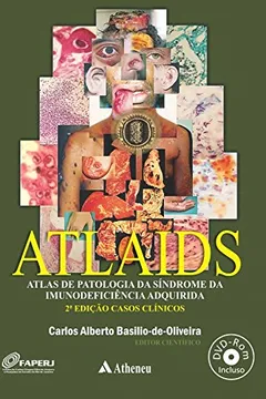 Livro Atlaids. Atlas de Patologia da Síndrome da Imunodeficiência Adquirida. Casos Clínicos - Resumo, Resenha, PDF, etc.