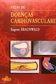 Livro Atlas de Doenças Cardiovasculares - Resumo, Resenha, PDF, etc.