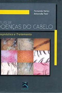 Livro Atlas De Doenças Do Cabelo. Diagnostico E Tratamento - Resumo, Resenha, PDF, etc.