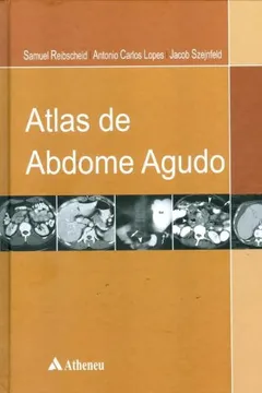 Livro Atlas Do Abdome Agudo - Resumo, Resenha, PDF, etc.