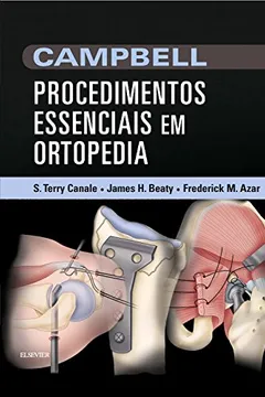 Livro Campbell Procedimentos Essenciais em Ortopedia - Resumo, Resenha, PDF, etc.