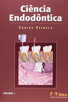 Livro Ciência Endodôntica - 2 Volumes - Resumo, Resenha, PDF, etc.