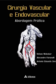 Livro Cirurgia Vascular e Endovascular. Abordagem Prática - Resumo, Resenha, PDF, etc.