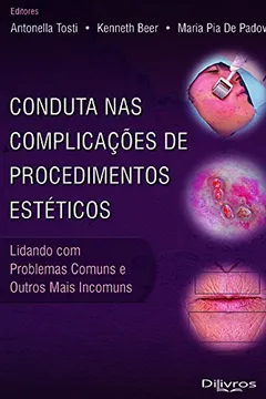 Livro Conduta nas Complicações de Procedimentos Estéticos. Lidando com Problemas Comuns e Outros Mais Incomuns - Resumo, Resenha, PDF, etc.