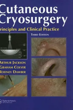 Capa do livro Cutaneous Cryosurgery: Principles and Clinical Practice