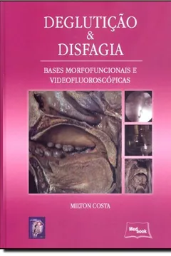 Livro Deglutição e Disfagia - Resumo, Resenha, PDF, etc.