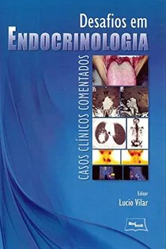 Livro Desafios em Endocrinologia. Casos Clínicos Comentados - Resumo, Resenha, PDF, etc.