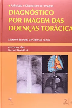 Livro Diagnostico Por Imagem Das Doenças Toracicas - Série Radiologia E Diagnostico Por Imagem - Resumo, Resenha, PDF, etc.