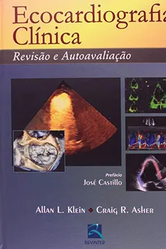 Livro Ecocardiografia Clinica. Revisão E Autoavaliação - Resumo, Resenha, PDF, etc.
