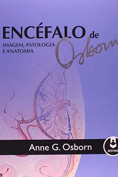 Livro Encéfalo de Osborn. Imagem, Patologia e Anatomia - Resumo, Resenha, PDF, etc.