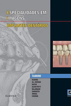 Livro Especialidades em Imagens. Implantes Dentários - Resumo, Resenha, PDF, etc.