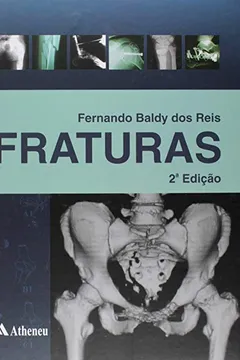 Livro Fraturas - Resumo, Resenha, PDF, etc.