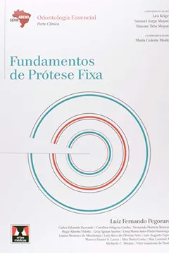 Livro Fundamentos de Prótese Fixa - Coleção Abeno - Resumo, Resenha, PDF, etc.