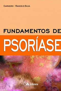 Livro Fundamentos de psoríase - Resumo, Resenha, PDF, etc.