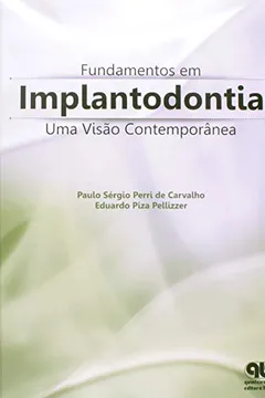Livro Fundamentos em Implantodontia. Uma Visão Contemporânea - Resumo, Resenha, PDF, etc.