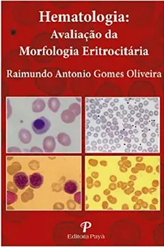Livro Hematologia - Avaliação da Morfologia Eritrocitária - Pranchas - Resumo, Resenha, PDF, etc.