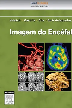 Livro Imagem do Encéfalo - Resumo, Resenha, PDF, etc.