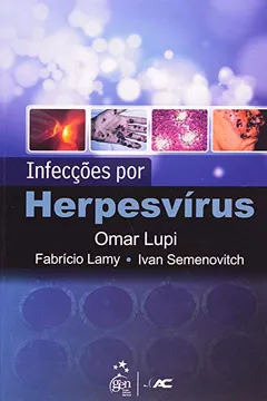 Livro Infeccoes Por Herpesvirus - Resumo, Resenha, PDF, etc.