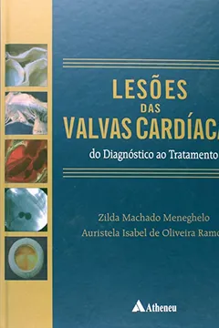 Livro Lesões Das Valvas Cardíacas.Do Diagnostico Ao Tratamento - Resumo, Resenha, PDF, etc.