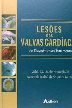 Capa do livro Lesões Das Valvas Cardíacas.Do Diagnostico Ao Tratamento