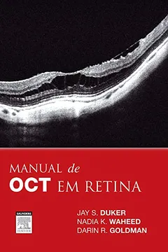 Livro Manual de OCT em Retina - Resumo, Resenha, PDF, etc.