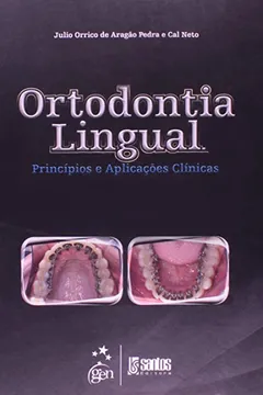 Livro Ortodontia Lingual - Principios E Aplicacoes Clinicas - Resumo, Resenha, PDF, etc.