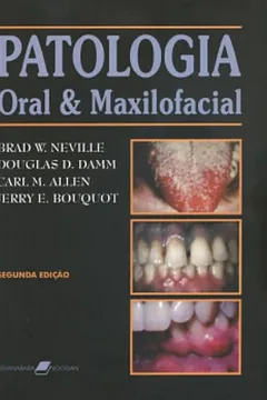 Livro Patologia Oral E Maxilofacial - Resumo, Resenha, PDF, etc.