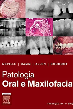 Livro Patologia Oral e Maxilofacial - Resumo, Resenha, PDF, etc.