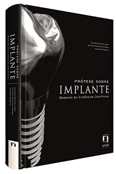 Livro Prótese Sobre Implantes. Baseado em Evidências Científicas - Resumo, Resenha, PDF, etc.