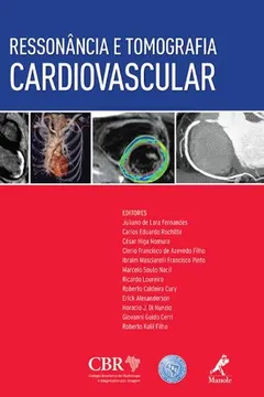 Livro Ressonância e Tomografia Cardiovascular - Resumo, Resenha, PDF, etc.