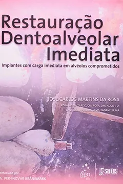 Livro Restauracao Dentoalveolar Imediata - Implantes Com Carga Imediata Em A - Resumo, Resenha, PDF, etc.