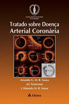 Livro Tratado Sobre Doença Arterial Coronária - Resumo, Resenha, PDF, etc.