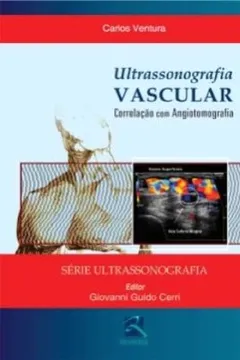 Livro Ultrassonografia Vascular. Correlação Com Angiotomografia - Resumo, Resenha, PDF, etc.